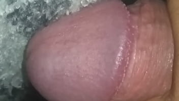 Papulas perladas sexo oral