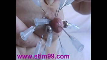 Xvideos injection
